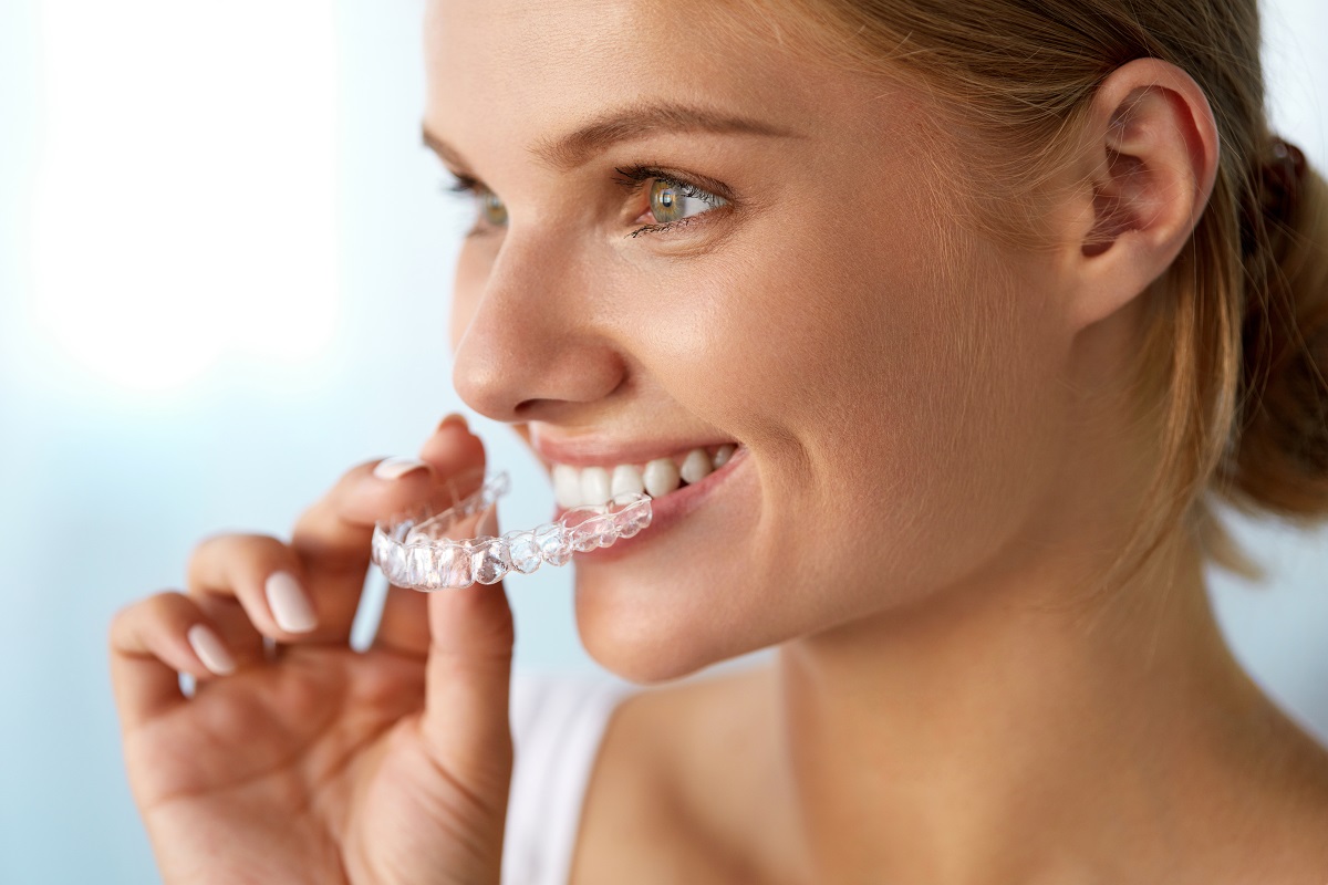 Avadent Invisalign.jpg
